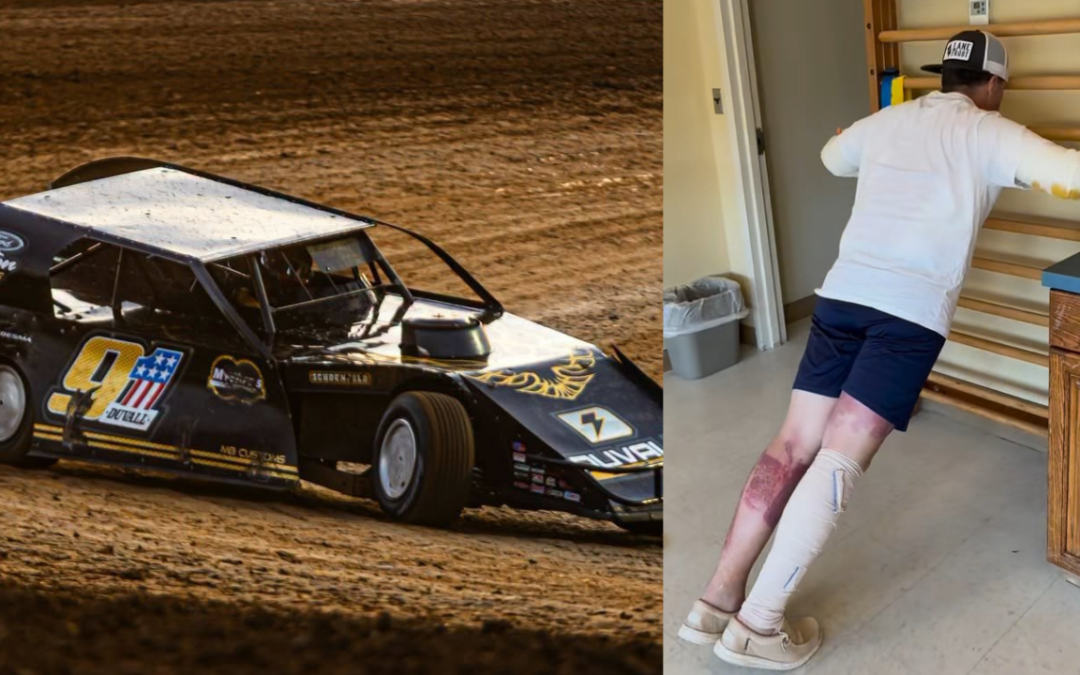 Joe Duvall Shares Rehabilitation Video After Suffering 3rd Degree Burns On 48% Of His Body And Promises “I Will Be Back”